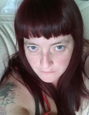 I'm a yummy mummy to lily who's 5 and Jake who's 4 plus I'm a survivor of necrotising fascitis