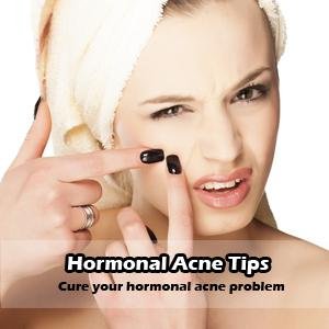 Cure your acne problem right now