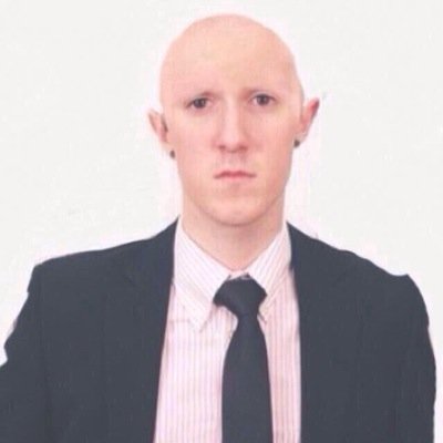 adam is bald af
