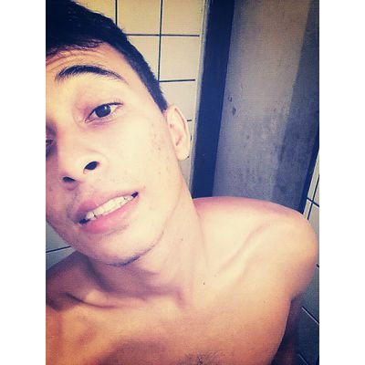 20 Natal