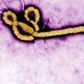 A level 4 pathogen, the Ebola virus is pound for pound the deadliest disease known to man. Ebola has a mortality rate of over 80%. Super - Edition.