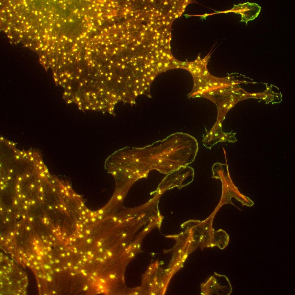 The Birmingham Platelet Group adopts a multidisciplinary approach in the investigation of platelet and megakaryocyte biology.