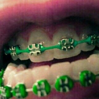 لحد يدخل خاص ...! #مرتبط