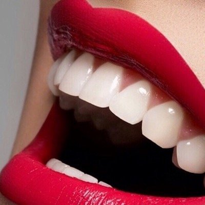 No1 for home teeth whitening kits in the UK.
Just £17.95 - safe & secure payments via PayPal.
Drop us a email at -NorthernWhitening@hotmail.com