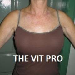 @Vitiligoprotocl