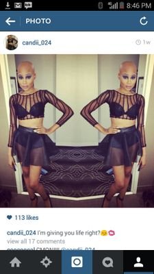 Hey there!! Danielle here i am a bald model with Alopecia Universalis. I model to support those suffering from hairloss. Hair doesnt define who we are as people