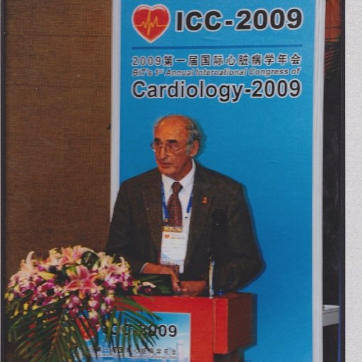 Working to solve the puzzle of peripartum cardiomyopathy since 1984 in Africa, Caribbean (Haiti), USA, Canada.  See PubMed, fett jd.