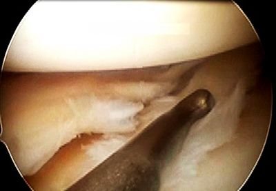 Orthopaedic surgeon. Interested in evidence-based knee knee surgery.