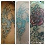 blankcanvaswy's profile picture. Blank Canvas Laser Tattoo Removal & IPL Beauty Treatments in Castleford, Pontefract, Knottingley & Retford
07919083838 / 07407420221