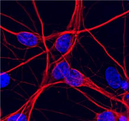 The Hooper lab at the University of Manchester. Undertaking research on the cell biology of Alzheimer's disease and ageing.