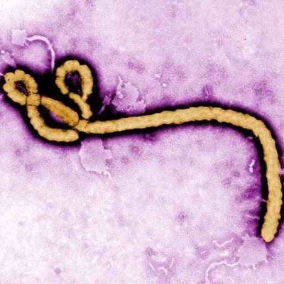 ebolarealfacts's profile picture. W-SR Bio 2's true facts and research about Ebola.