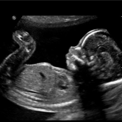 UnBornBabyAri's profile picture. unborn Mummy; @Madisonb33rx and Daddy: @Jason_Mccann4