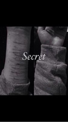 Self Harm * Suicidal * 22 * Girl * Relapsed After 37 Months * Still trying to recover again * Secret Account *