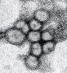 こんにちはインフルエンザウイルスです。新人のエボラ君の活躍に負い目を感じております…。