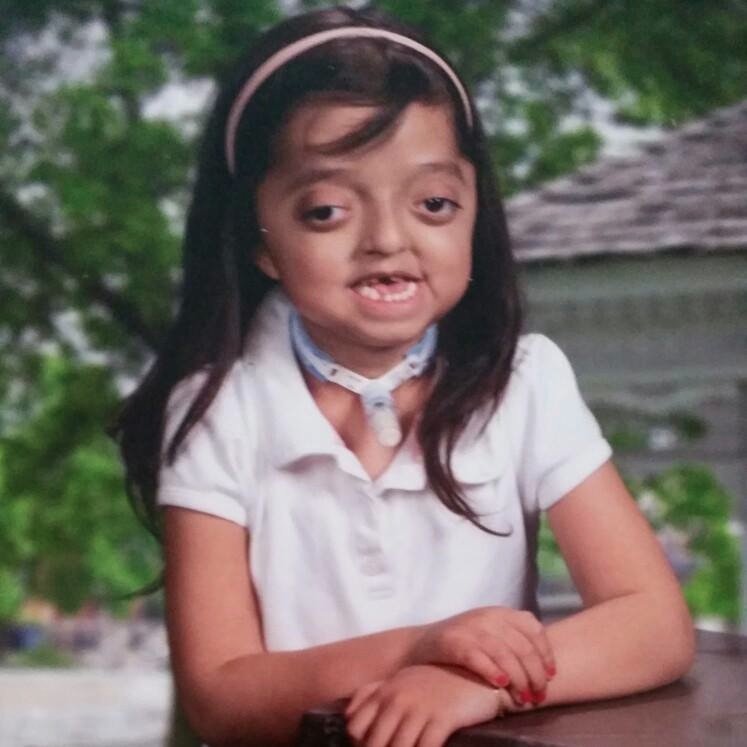 Hello everyone my niece Angelina is 6 years old and she has Crouzon's Syndrome. She loves Ellen and watches her show everyday. We want Angie to meet Ellen.