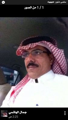 ‏‏ت حتفل بالجرح