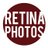Retina Photos