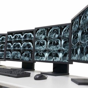 SAUDI_PACS's profile picture. For all PACS Adminstrators in Saudi Arabia, this account is to share ideas and experience in Imaging informatics field..
This account is not governmental