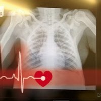 Ape Heart Project (@ape_heart_study) 's Twitter Profile