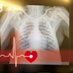 Ape Heart Project (@ape_heart_study) Twitter profile photo
