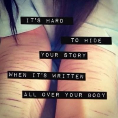 new account // female | 17 | england | self harm | depression | anxiety | fat | i hope you're having a good day ❤️ venting account; trigger warning