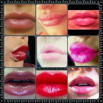Nurse offering Anti wrinkle injections, Fillers, Dermaroller, peels, PRP, Thredlifts and microdermabrasion