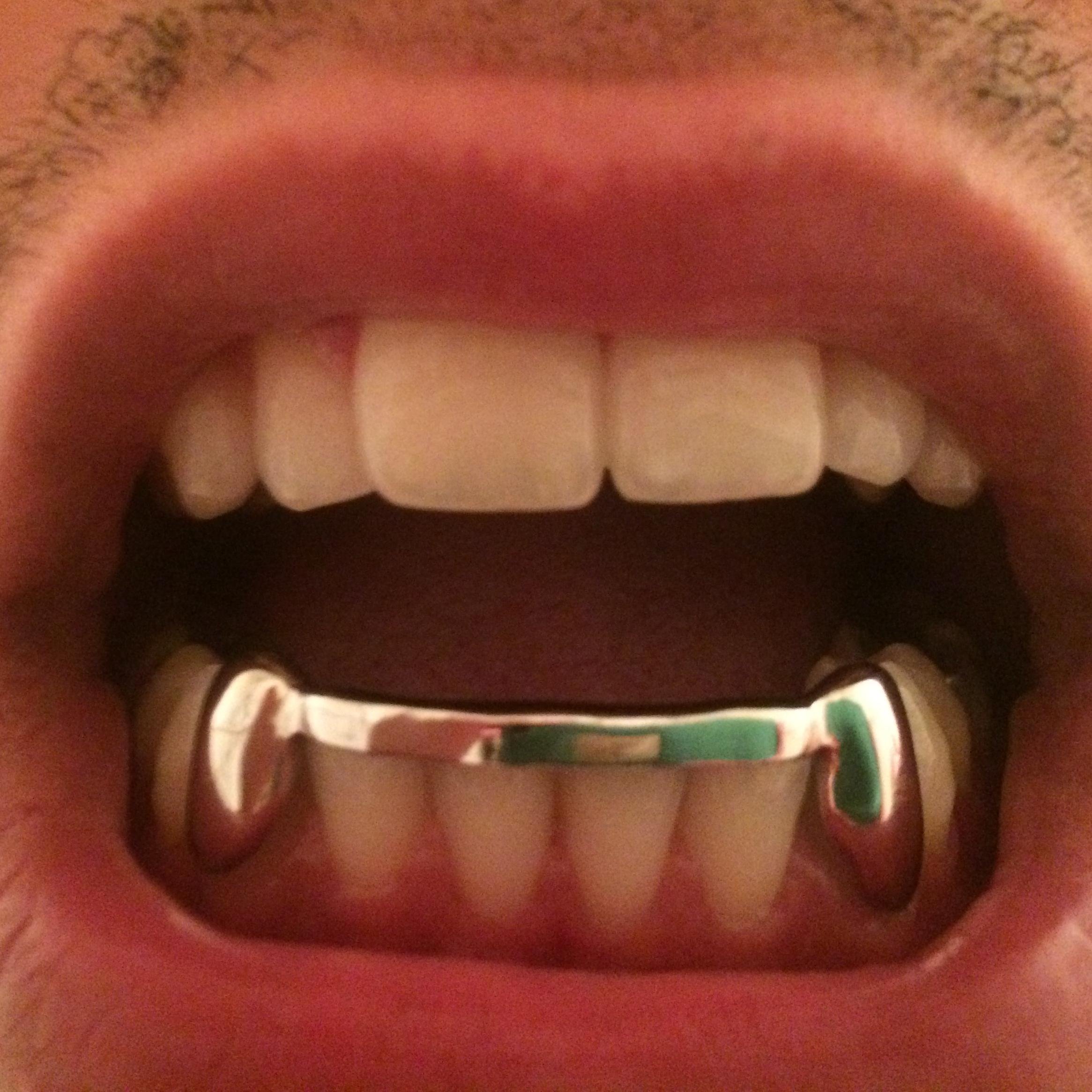 Doctor Grillz In Paris contact : DoctorGrillz@gmail.com Insta : DoctorGrillz
