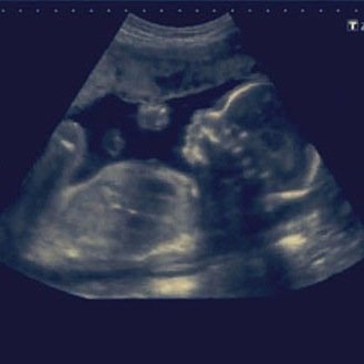 baby_babe08's profile picture. [RP||unborn baby|| Bio under construction (Mum : @Aalasskaa ) (Dad: @loverboybaker )