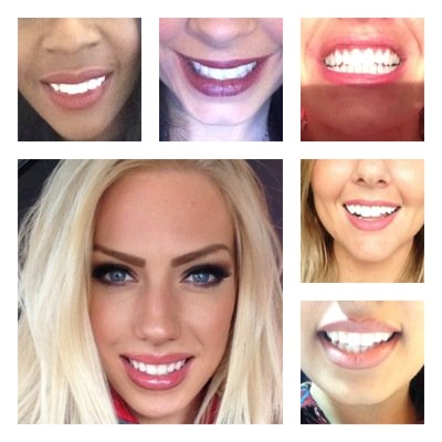 UK's fastest growing online teeth whitening service......producing professional custom made home teeth whitening packs for a fraction of dentist prices