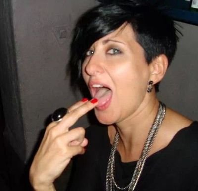 I´m forever black eyed.