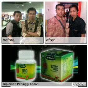 Solusi untuk wajah cerah, bebas jerawat, flek hitam dan keriput Pin: 267972B6 / 089676233381 Terbukti!