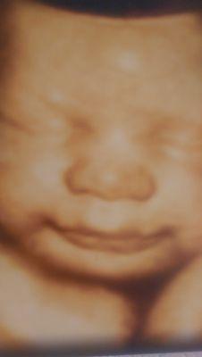 Provider of 4D and 2D baby scans based in the North East of England. 01642 218070