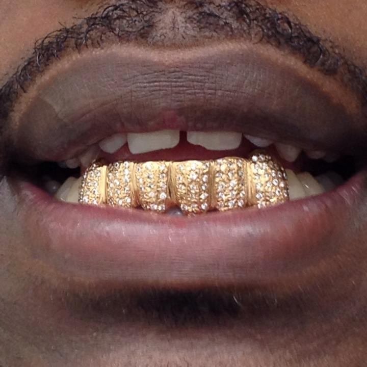 Gold Teeth, Gold Grillz & Diamond Specialist