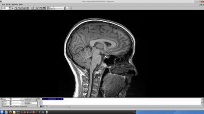 Lecturer & neuroscientist at University of Nottingham. Interested in how the central nervous system regulates pain.