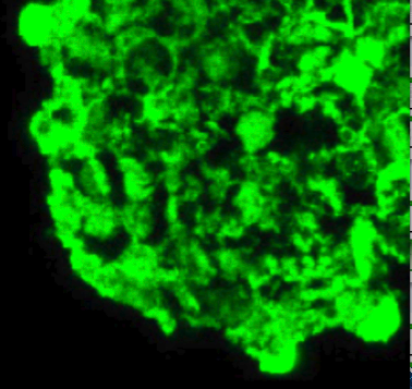 StemCellGBC's profile picture. The Stem Cell GBC will engage the world to develop harmonized guidelines for development of stem cell therapies for spinal cord injury and related disorders.