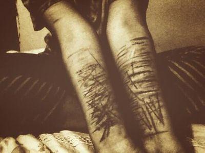 | Depression | Bipolar Disorder | Taken ♡ |