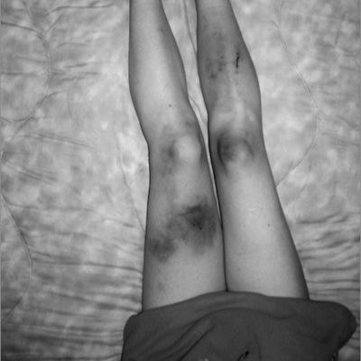 15. self harm. depression. anxiety. eating disorder. lesbian.