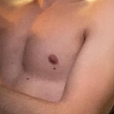 Mole near nipple