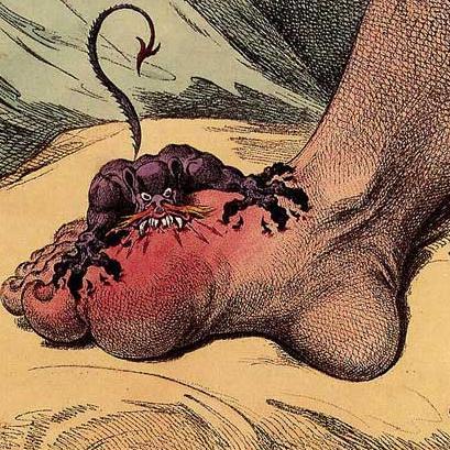 Trying to help people with this painful arthritis