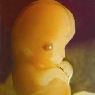 #YaMeCanse del Aborto #NoAlAborto | @RebeccaKiesslin, a woman conceived in rape (una mujer concebida en una violación)
