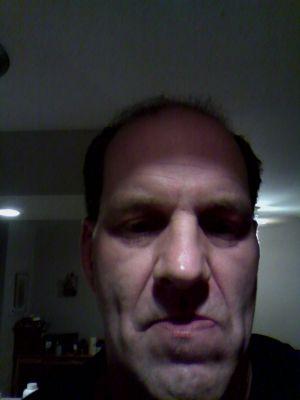 Im disabled with neuropathy and beginning stages of MS.