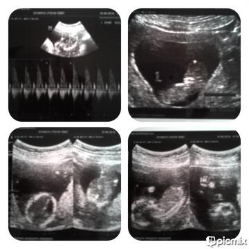 He's my everything..' Tian janis'