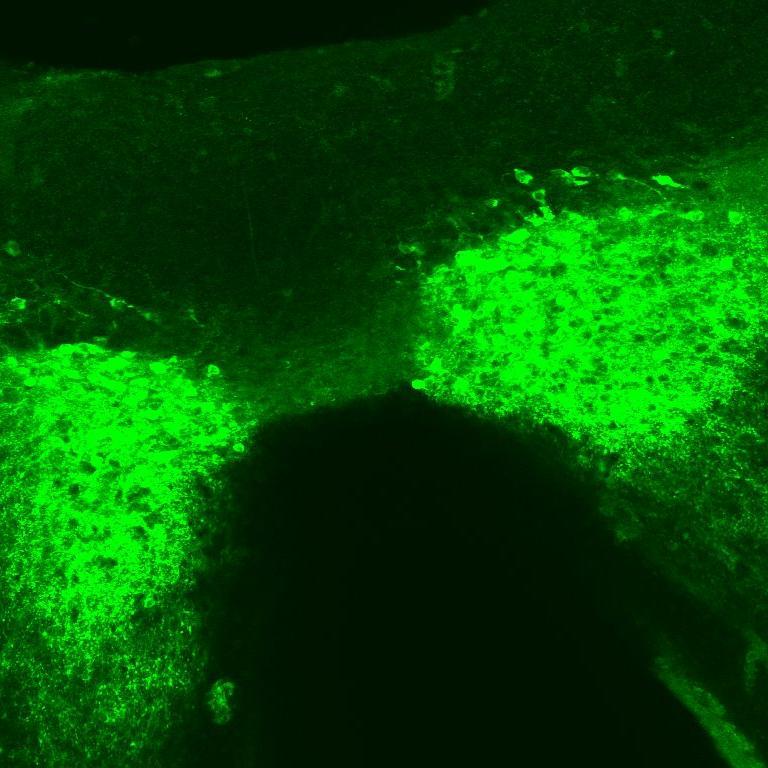 molecular & behavioral neuroscience. messy & misbehaving kids.