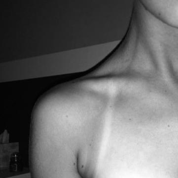 slowly receding