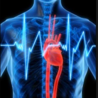 HaydonExamPE's profile picture. Sport, health and all things exercise related for GCSE, A-Level and BTEC students at Haydon School.