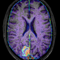 UofMStrokeResearch (@uofmstrokeres) 's Twitter Profile