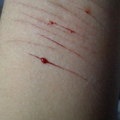 Me quiero morir'