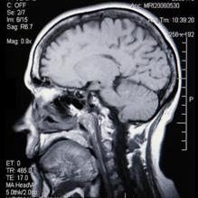 brain_rontgen's profile picture. 