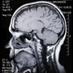 Fatih Beyazıt (@brain_rontgen) Twitter profile photo Fatih Beyazıt (@brain_rontgen) Twitter profile photo