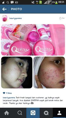 ♥ skincare ♥ katalog ceheck favorite ♥
 ✉ 085642228972 pin:32A05983 ♥ grosir.ecer.dropship♥ NO TIPU - TIPU ♥ reseller welcome ♥